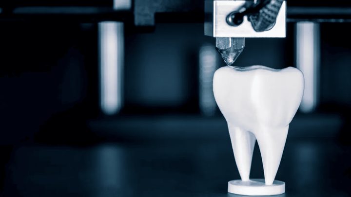 3D printing for dental labs